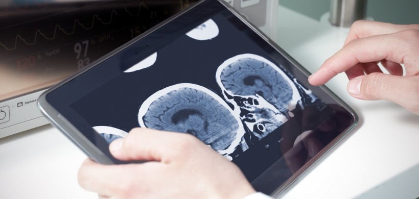 AlzhUp: Avances en la estimulación cognitiva y nuevas tecnologías